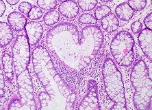 Cells forming a heart